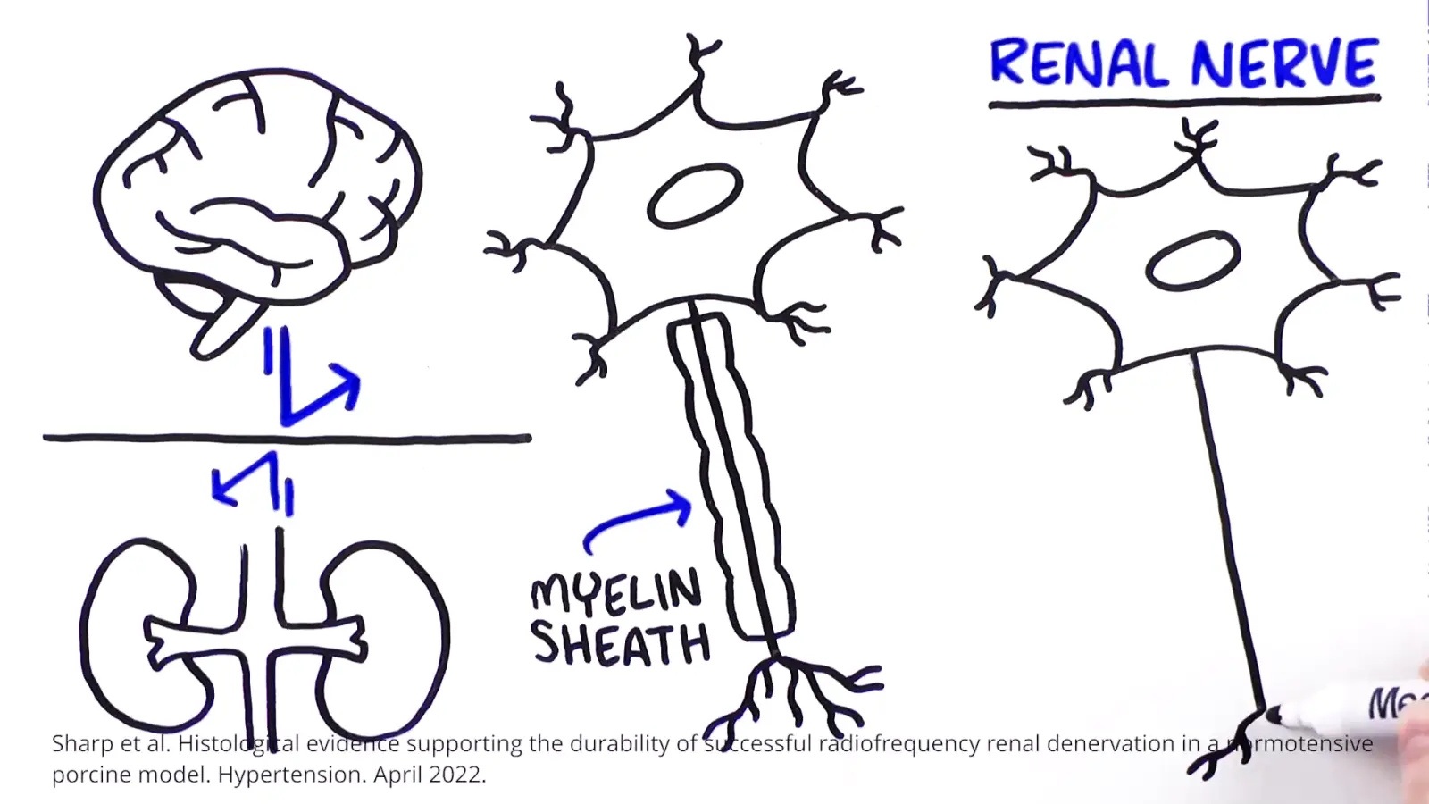 Frame from a TruScribe Life Sciences & Medical Communication video